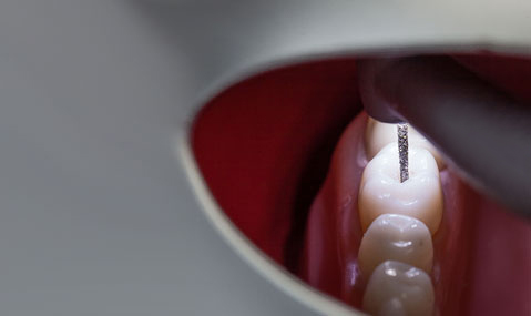 Waldent LED Airotor Handpiece And Cartridge