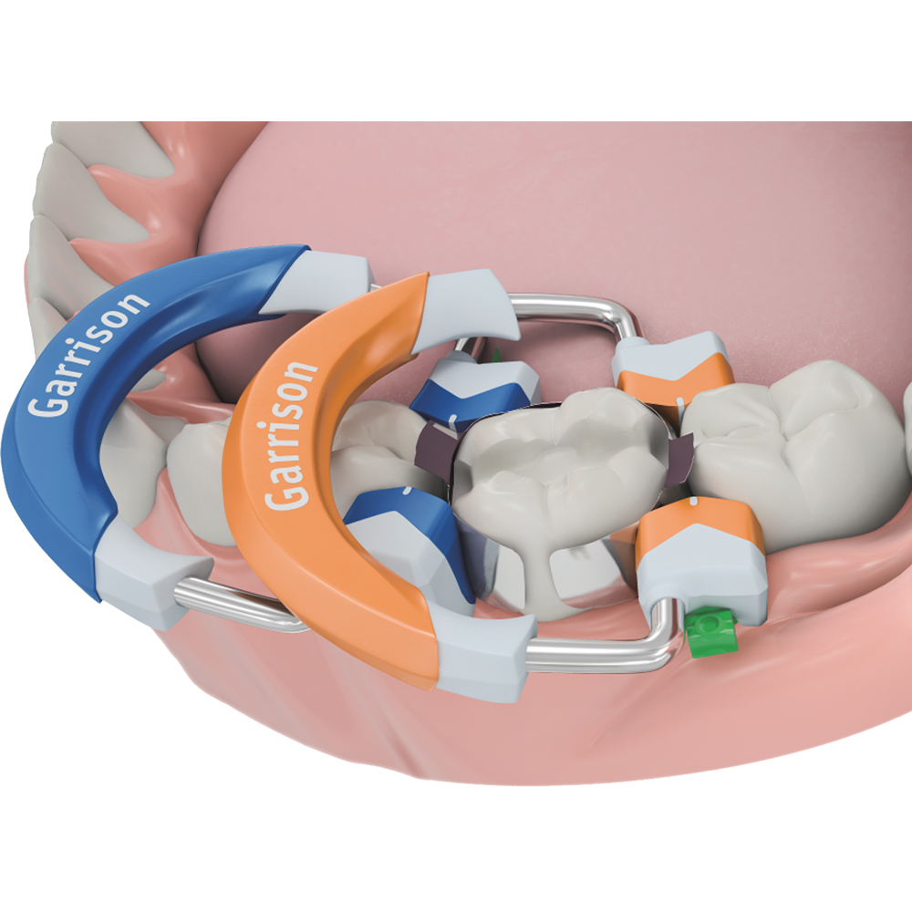 Garrison Dental Composi-Tight 3D Sectional Matrix System Kit