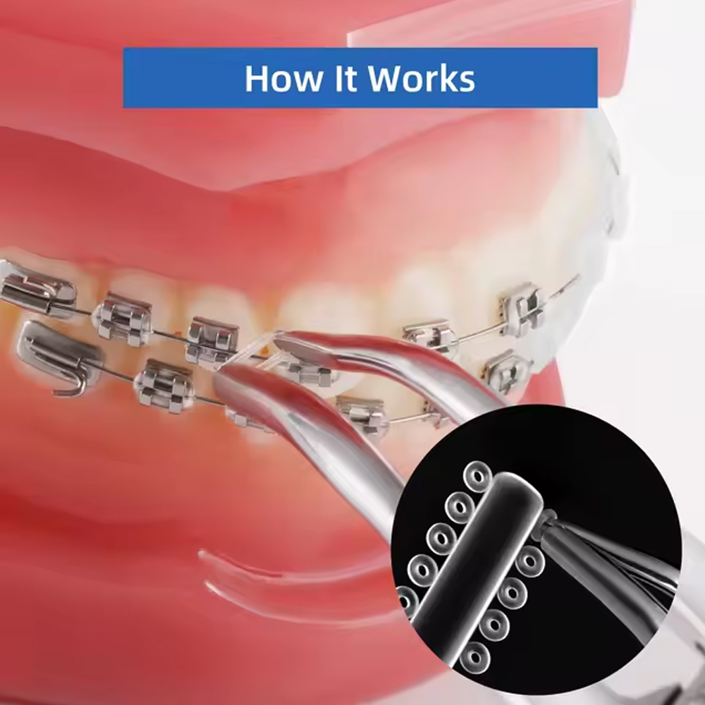 Prime Ortho Ligature Ties Ø0.12