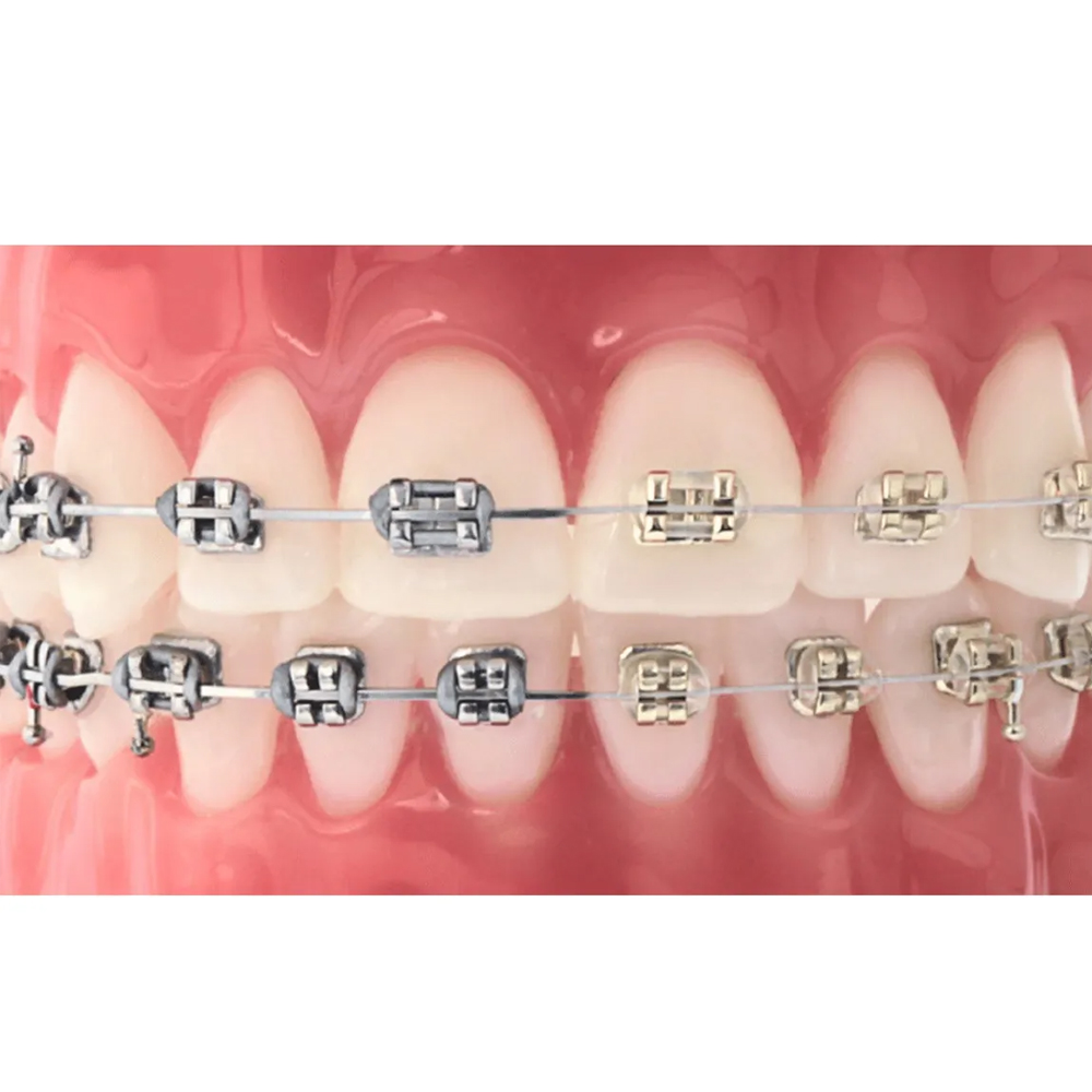 Prime Ortho Ligature Ties Ø0.12