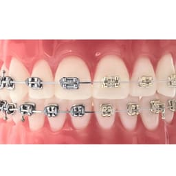 Prime Ortho Ligature Ties Ø0.12 - 7