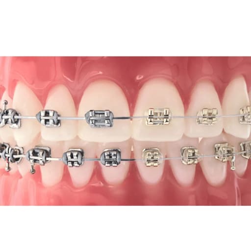 Prime Ortho Ligature Ties Ø0.12