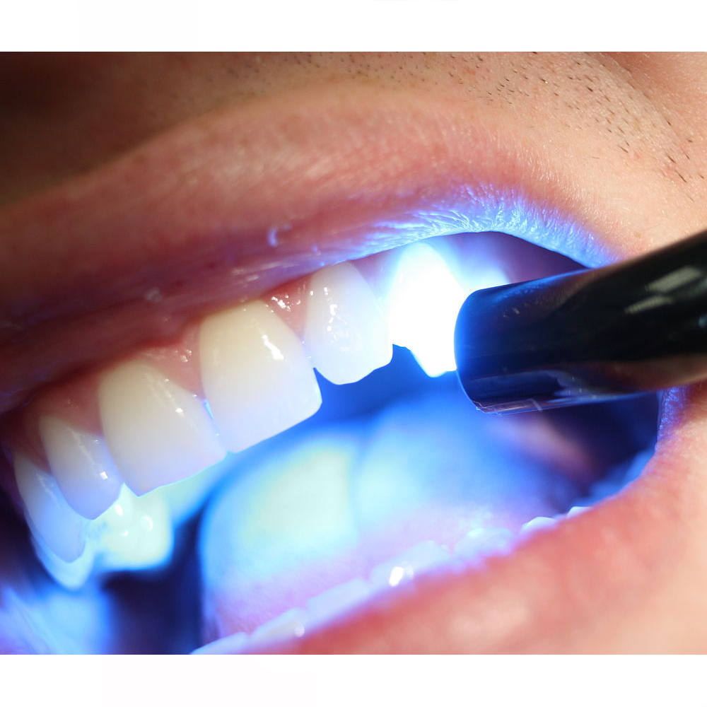 Woodpecker LED Light Cure Probes