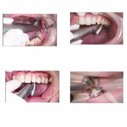 NSK Ti Max Z45L Handpiece (C1064) - 9