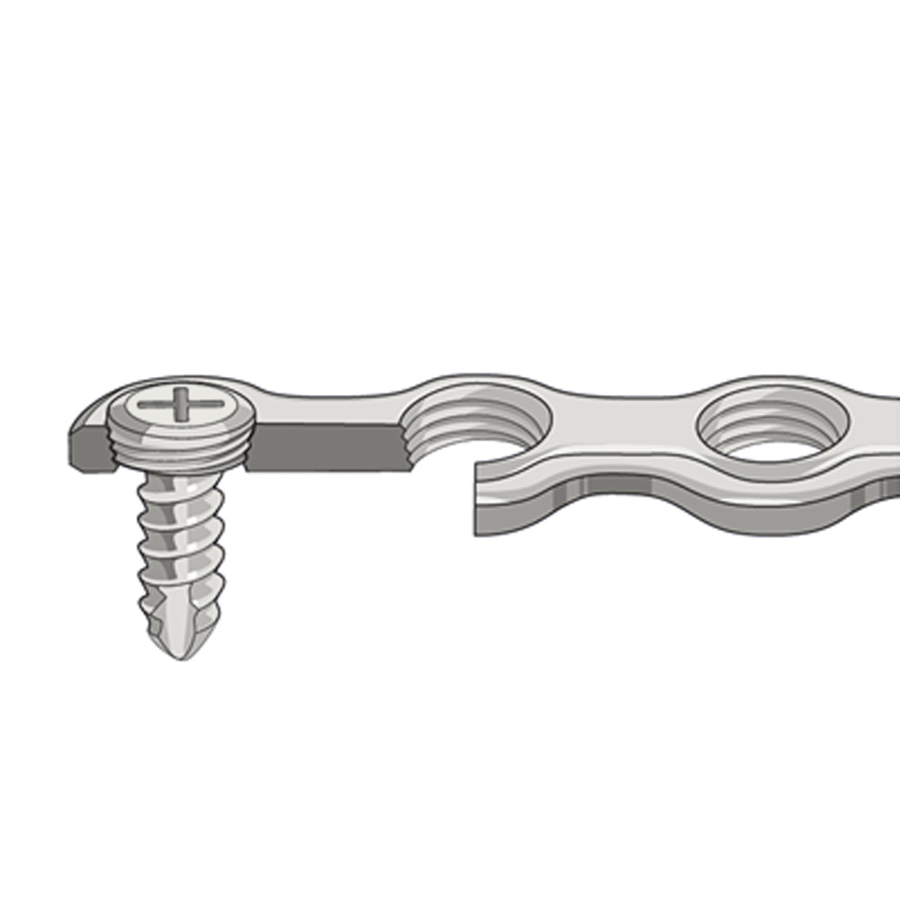 SK Surgicals SS Mini Bone Locking Plates - 2mm