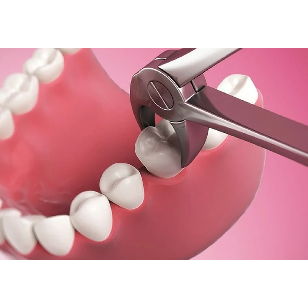 GDC Extraction Forceps Lower Molars - 22 Standard (FX22S)