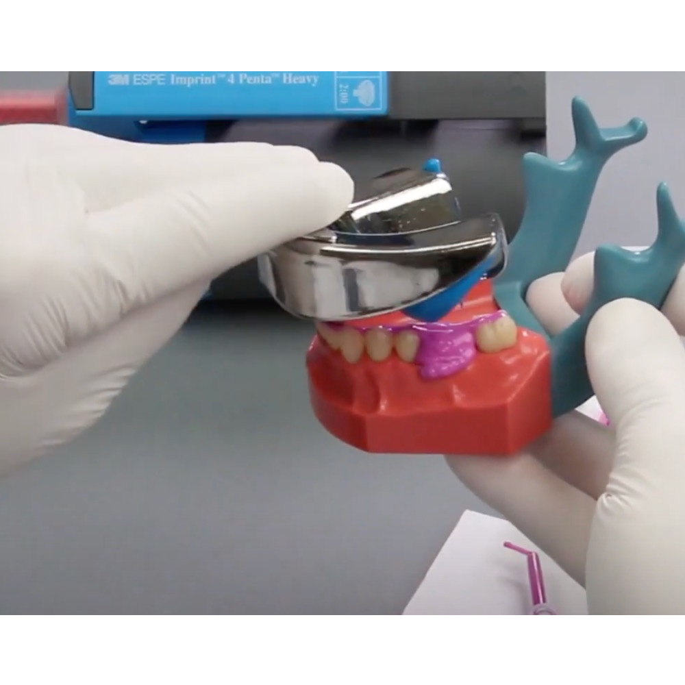 GDC Dentulous Non-Perforated Impression Trays Lower # 1 (Itrldnpl1)