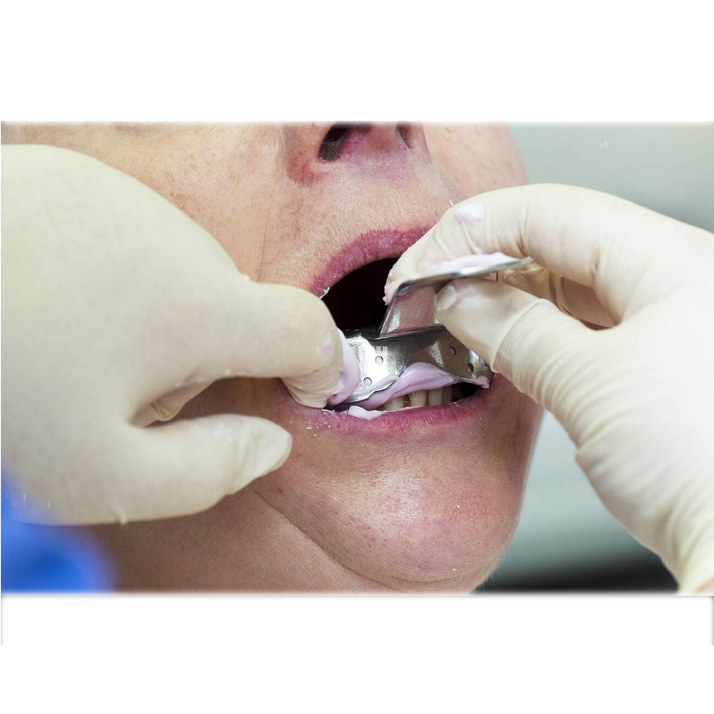 GDC Dentulous Perforated Impression Trays Lower # 1 (ITRLDPL1)