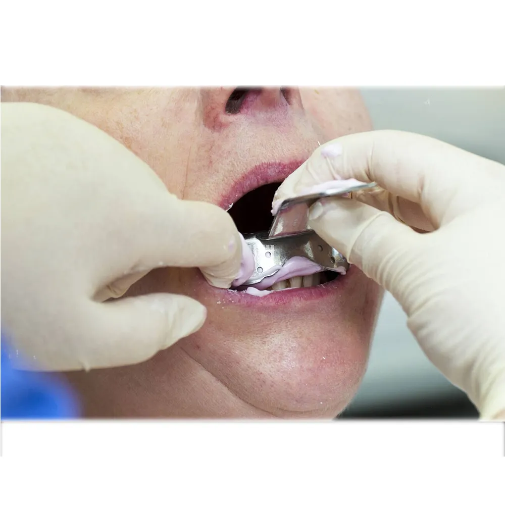 GDC Impression Tray Anterior And Posterior Lower (ITRLDPLA)