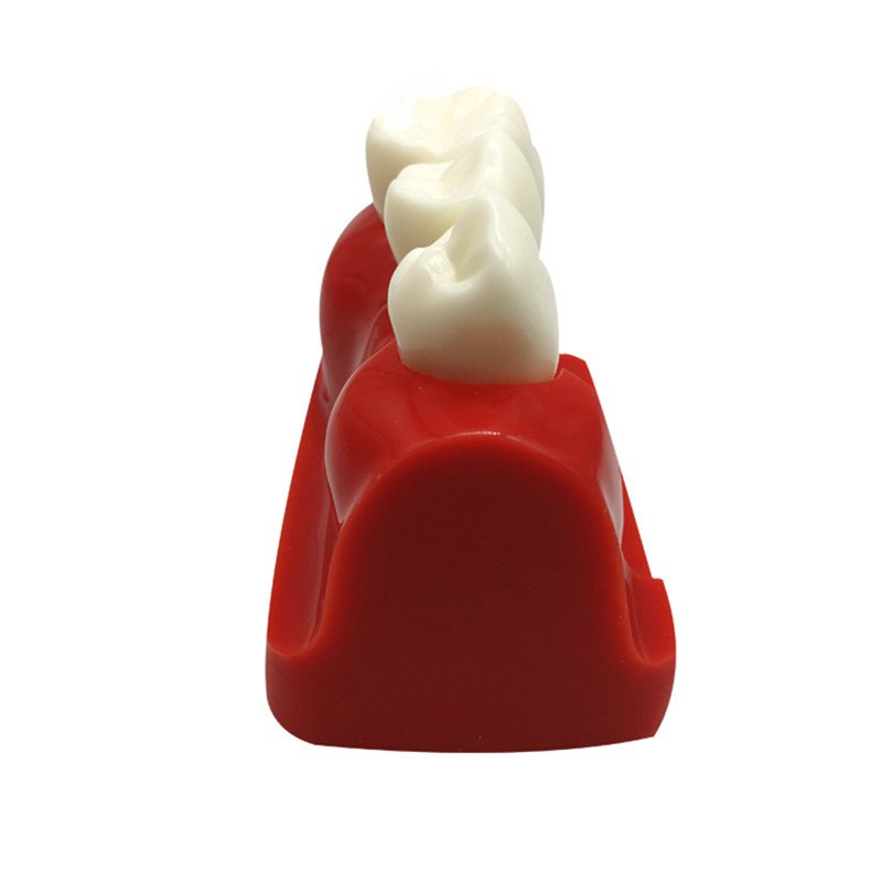 iDENTical Implant Analysis Model - M2017