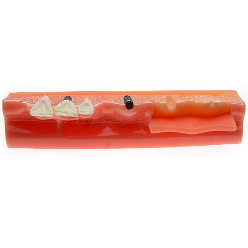 iDENTical Steps for Implant Model M2018