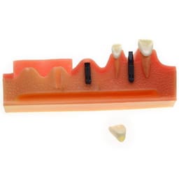 iDENTical Steps for Implant Model M2018 - 3