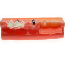iDENTical Steps for Implant Model M2018 - 4