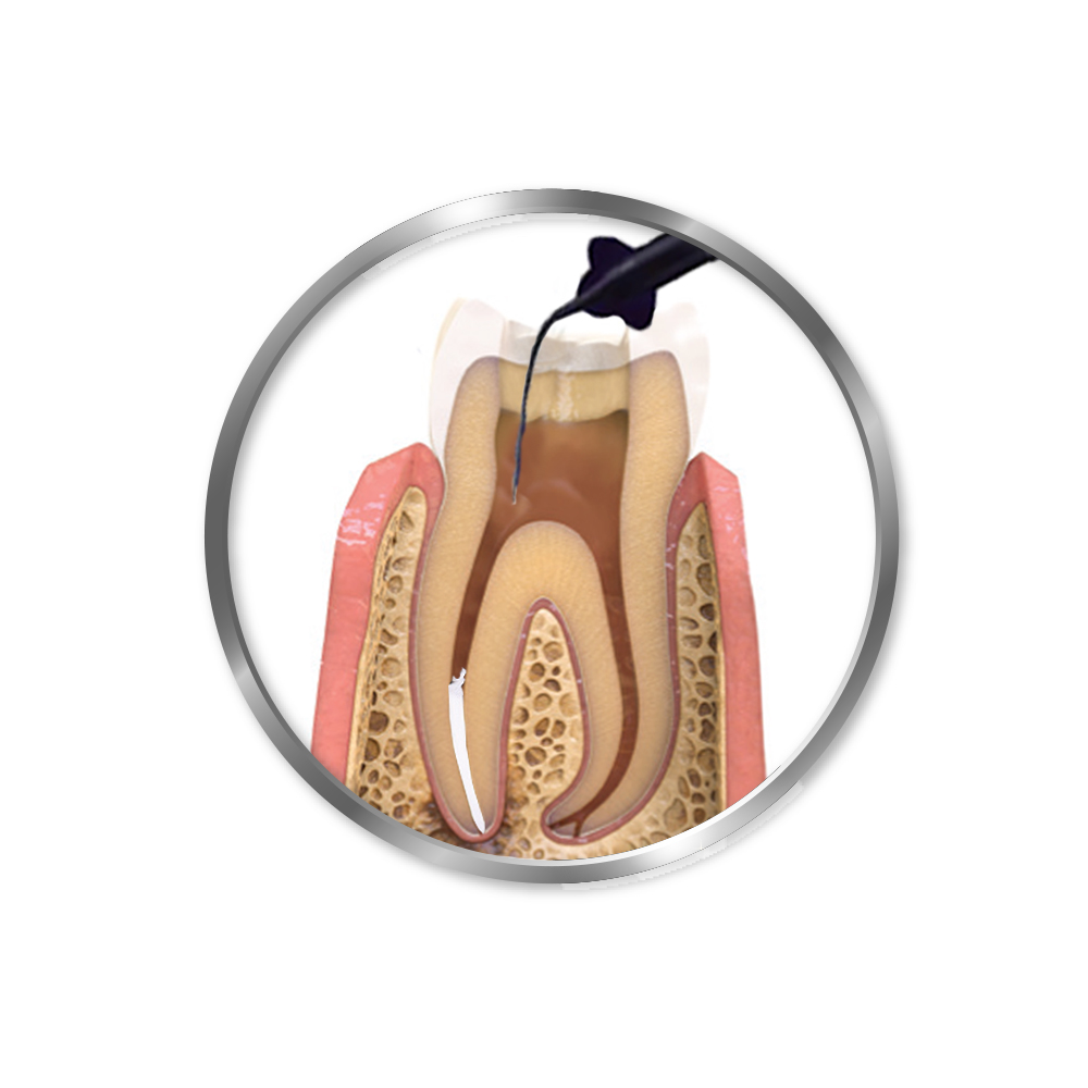 Maarc Calahyd-Rc (9103/15X2)