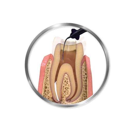 Maarc Calahyd-Rc (9103/15X2)