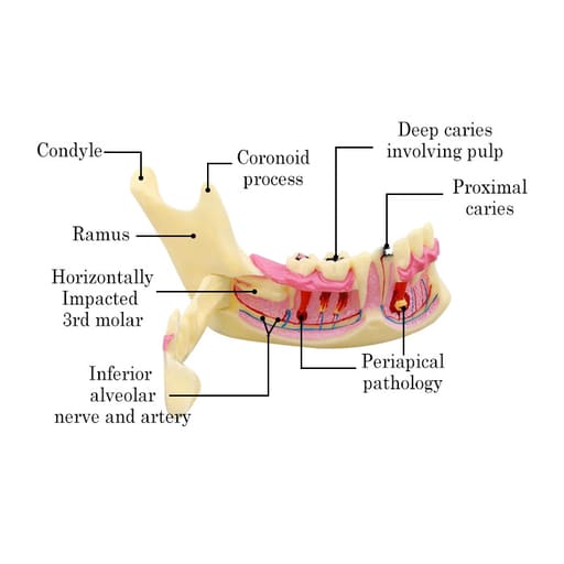 iDENTical Mandible Bone Model M4014