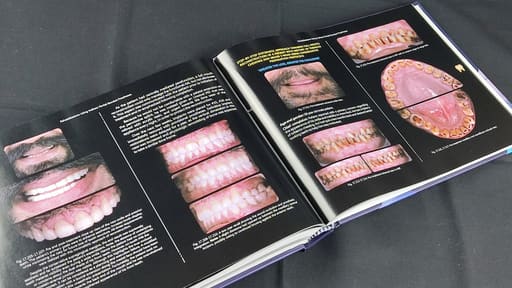 Clinical Fixed Prosthodontics- 2nd Edition Master Volume By Dr. Moez I Khakiani