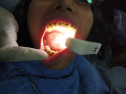 Waldent Maxbite Intraoral Lighting - 22