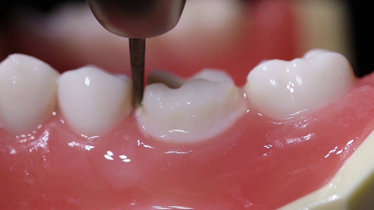 Mani Diamond Burs - Extra Fine / Ef Series