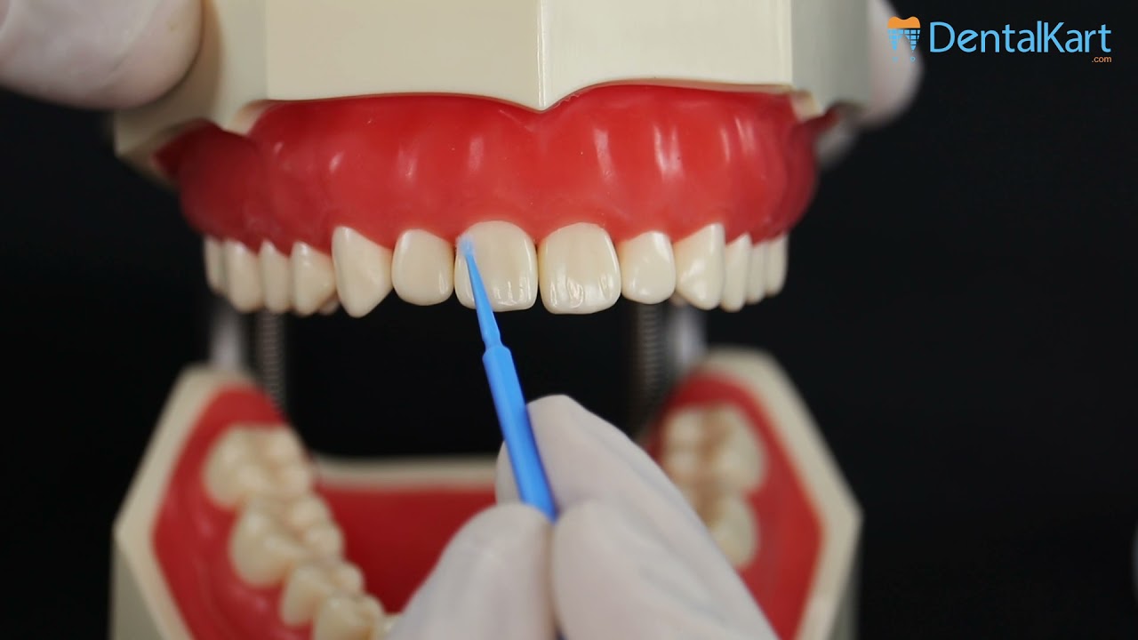 Cotisen Dental Micro Applicators Tips