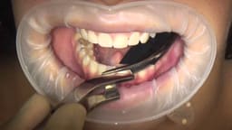 Bausch Dental Articulating Papers with Progressive Colour Transfer - 200µ Microns - 10