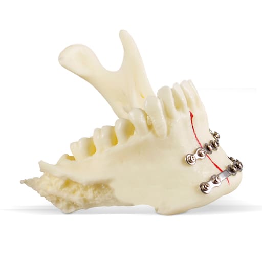 iDENTical Jaw with Titanium Plate Model M5001