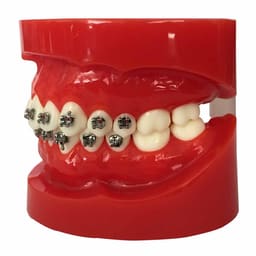 iDENTical Half Metal and Half Ceramic Brackets Orthodontic Models M3003 - 4