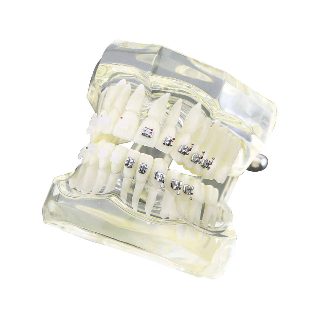 iDENTical Half Metal and Half Ceramic Brackets Orthodontic Models M3003