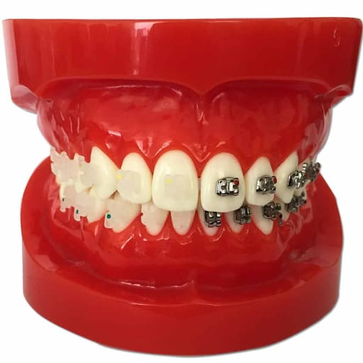 iDENTical Half Metal and Half Ceramic Brackets Orthodontic Models M3003