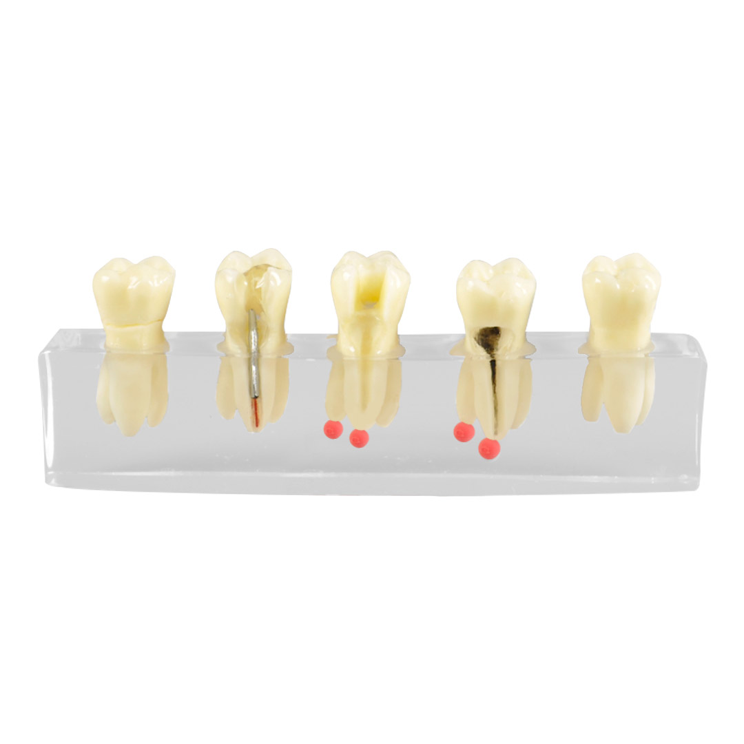 iDENTical Root Canal Model M4012