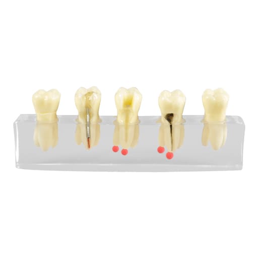 iDENTical Root Canal Model M4012