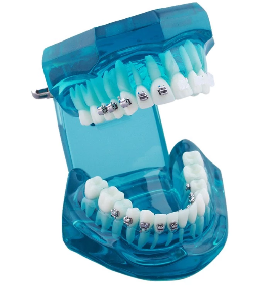 iDENTical Self Ligating Models M3012