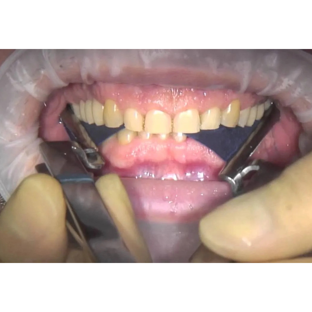 MDM Dental Articulating Paper