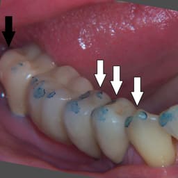MDM Dental Articulating Paper - 4