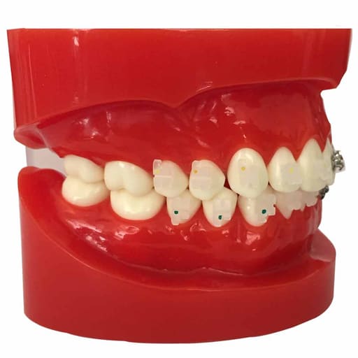 iDENTical Half Metal and Half Ceramic Brackets Orthodontic Models M3003