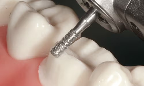 Mani Diamond Airotor Burs - Taper Flat End / Tf Series