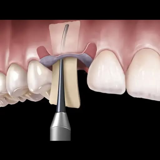 Oracraft Membrane Placement (PMPIS)