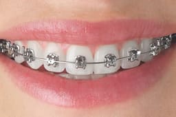 U Ortho NiTi Archwire -Ovoid(pack of 10) - 7