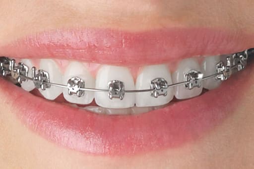U Ortho NiTi Archwire -Ovoid(pack of 10)
