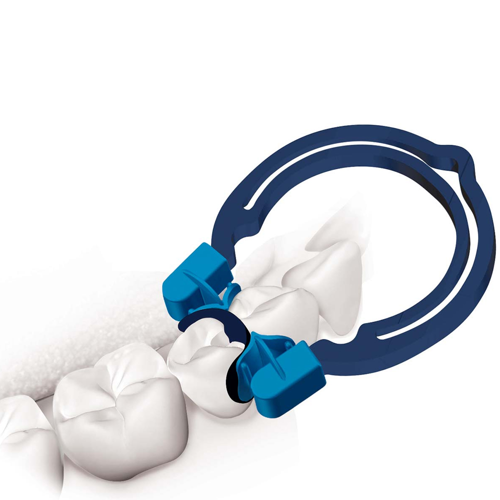 Polydentia MyQuickmat Forte Secional Matrix System Kit & Refills