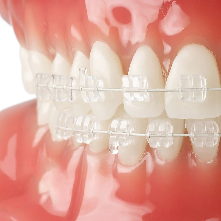 U Ortho SS Tooth Color Wire - Rectangular (Pack of 1)