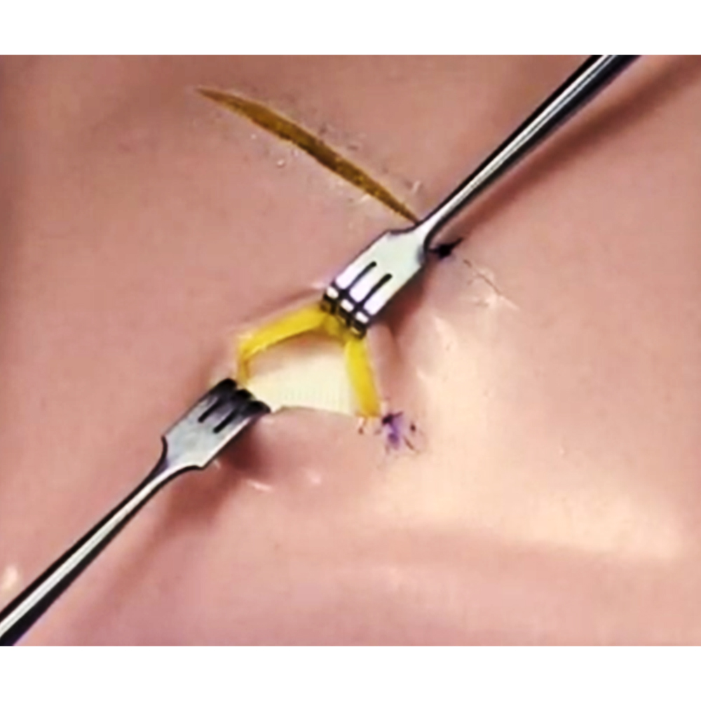 GDC Senn - Miller Sharp Tissue Retractor 16cm (Trsm1)