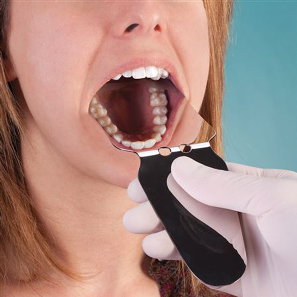 Sawbros Intraoral Photographic Mirrors