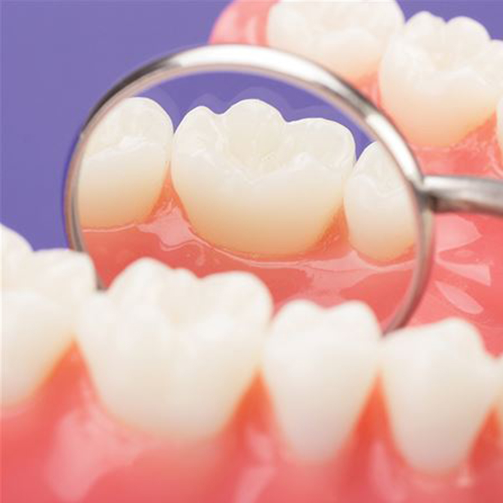 GDC Mouth Mirror Tops Plain Pack Of 12 Pcs - 4 (Mmtp4)