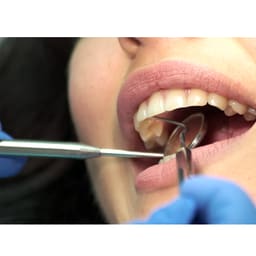 GDC Mouth Mirror Handle #2 (MH2) - 4