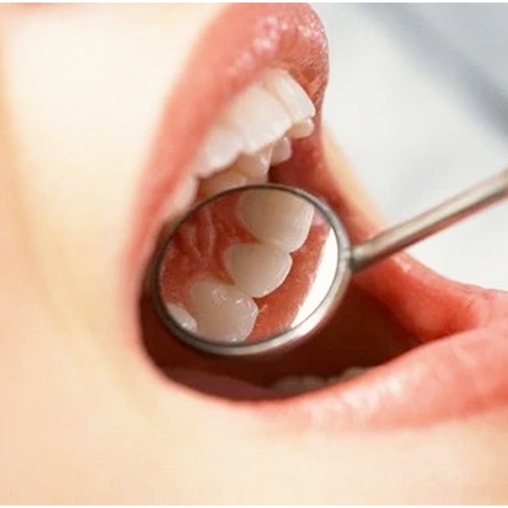 Waldent Mouth Mirror Tops Plain #3 Pack Of 12 (K13/7)