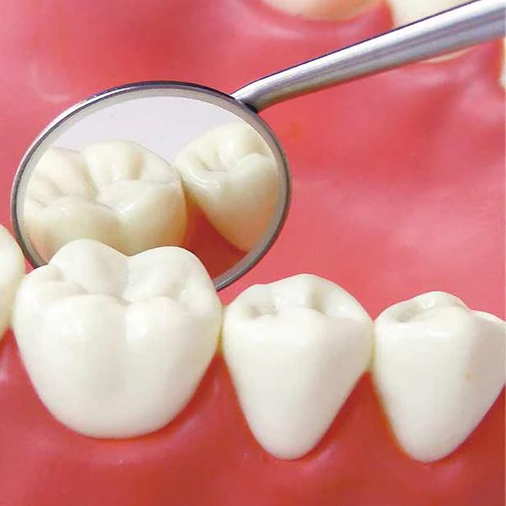 GDC Mouth Mirror Tops Fs Rhodium Coated Pack Of 12 Pcs - 5 (Mmtfs5)