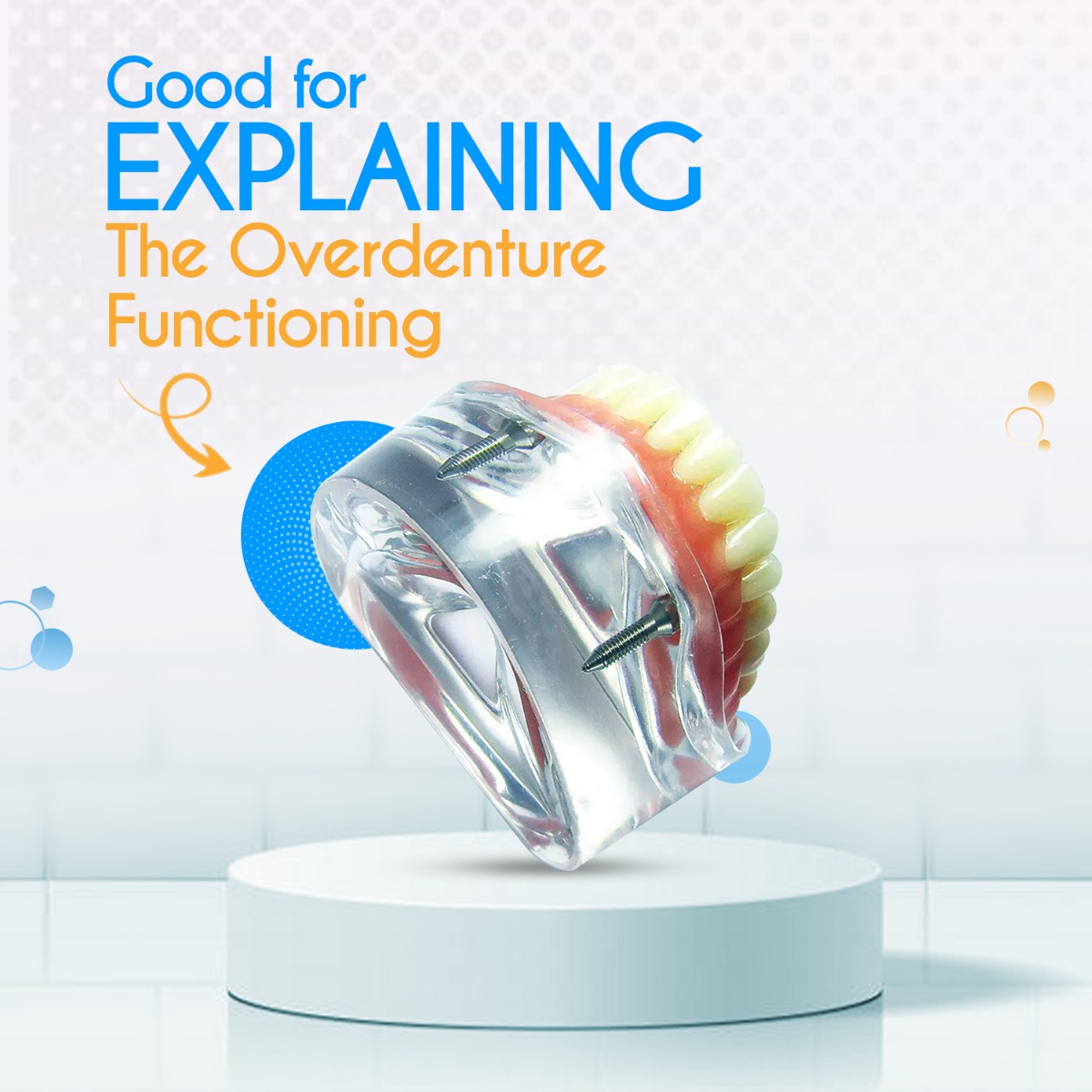 iDENTical Mandibular Overdenture Model with 2 Implants M6002