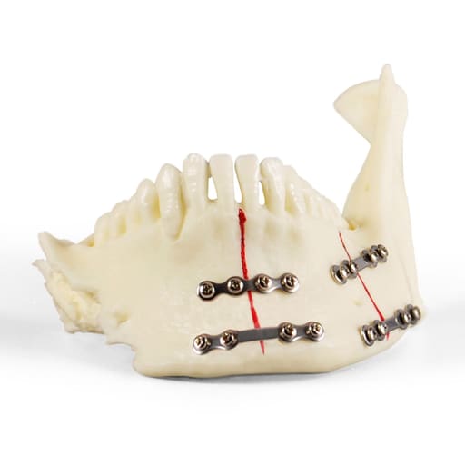 iDENTical Jaw with Titanium Plate Model M5001