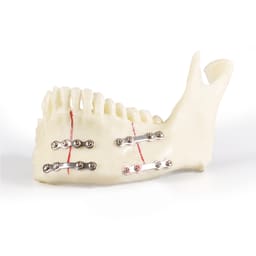iDENTical Jaw with Titanium Plate Model M5001    - 4
